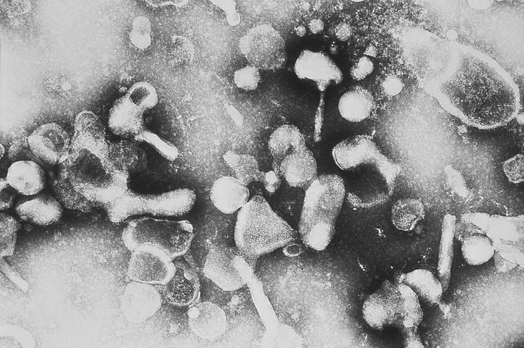 عکس واقعی مرتبط با FeLV / FIV: Feline leukemia virus.JPG