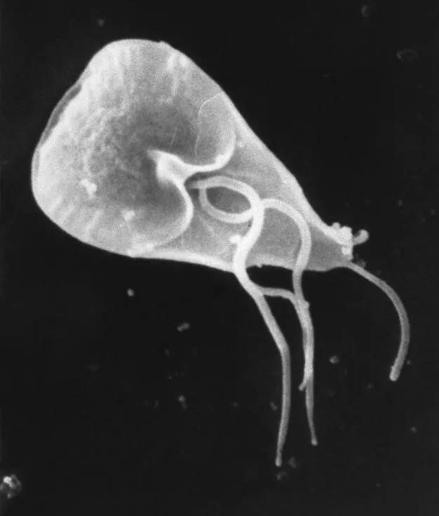 عکس واقعی مرتبط با ژیاردیا: Giardia lamblia SEM 8698 lores.jpg