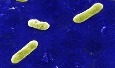عکس واقعی مرتبط با سرفه کنل: Bordetella bronchiseptica