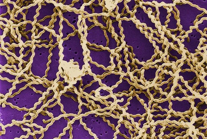 عکس واقعی مرتبط با لپتوسپیروز: Leptospira scanning micrograph.jpg