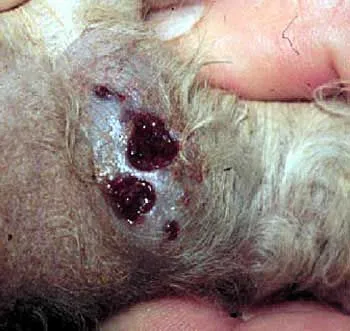 عکس واقعی مرتبط با کچلی (ریشهقارچی): Pseudomycetoma